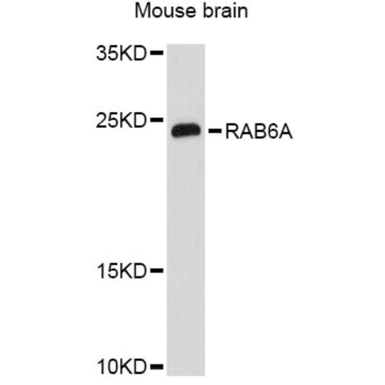 Western Blot - Anti-RAB6A Antibody (A12089) - Antibodies.com