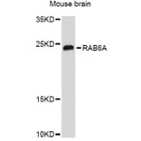 Western Blot - Anti-RAB6A Antibody (A12089) - Antibodies.com