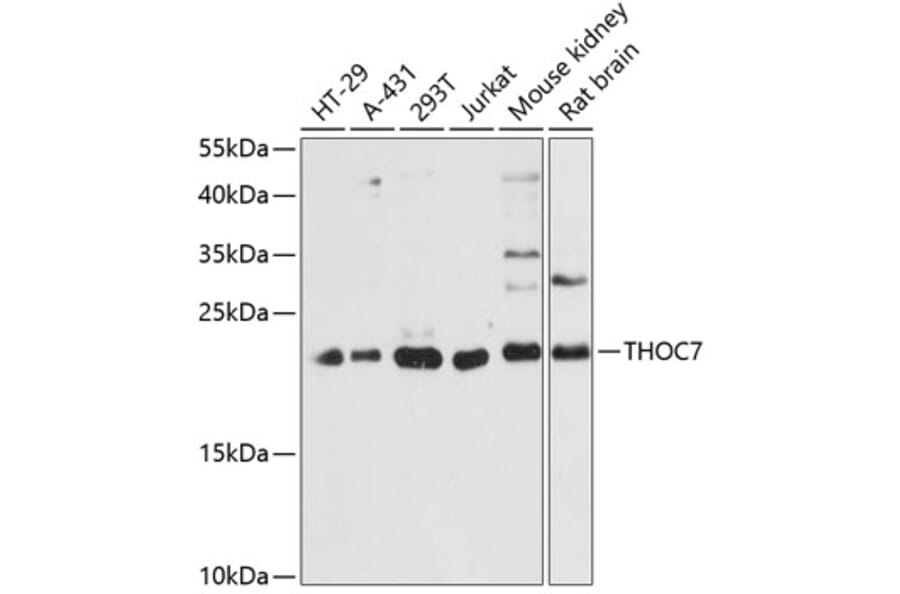 Western Blot - Anti-THOC7 Antibody (A88854) - Antibodies.com