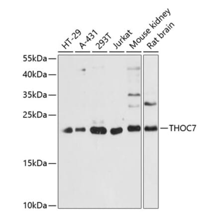 Western Blot - Anti-THOC7 Antibody (A88854) - Antibodies.com