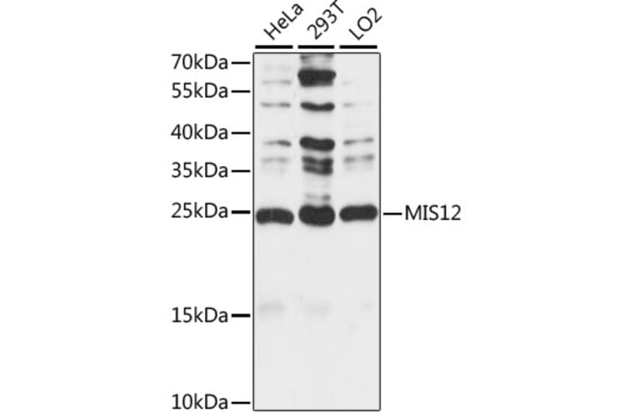 Western Blot - Anti-MIS12 Antibody (A88855) - Antibodies.com