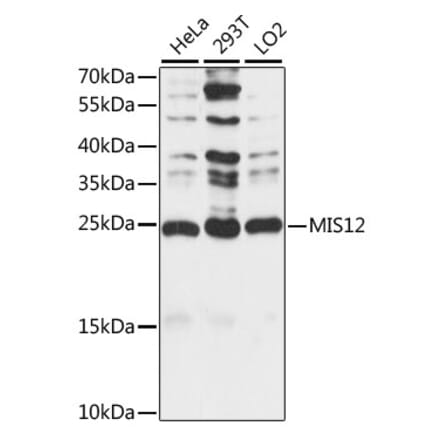 Western Blot - Anti-MIS12 Antibody (A88855) - Antibodies.com