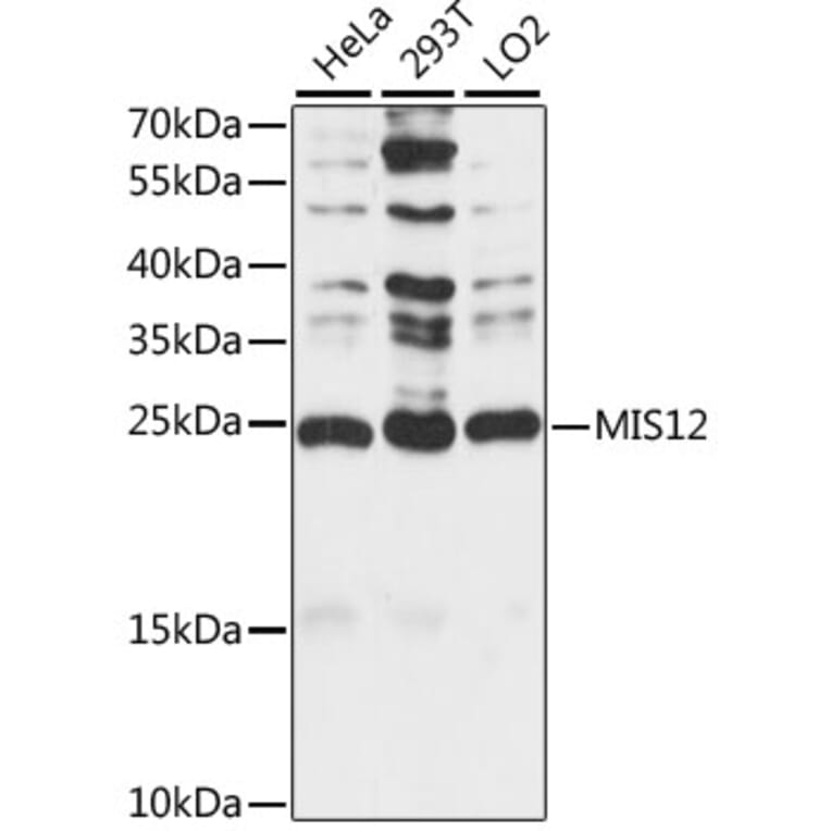 Western Blot - Anti-MIS12 Antibody (A88855) - Antibodies.com