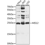 Western Blot - Anti-MIS12 Antibody (A88855) - Antibodies.com