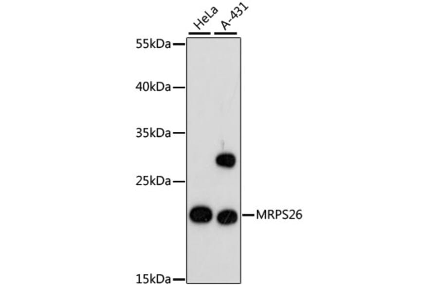 Western Blot - Anti-MRPS26 Antibody (A88856) - Antibodies.com