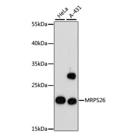 Western Blot - Anti-MRPS26 Antibody (A88856) - Antibodies.com