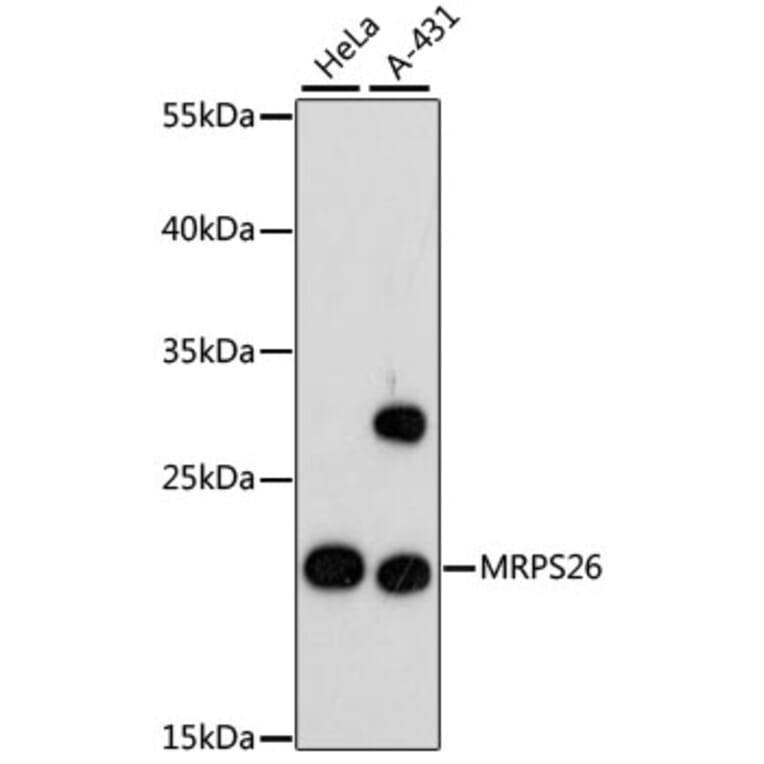 Western Blot - Anti-MRPS26 Antibody (A88856) - Antibodies.com