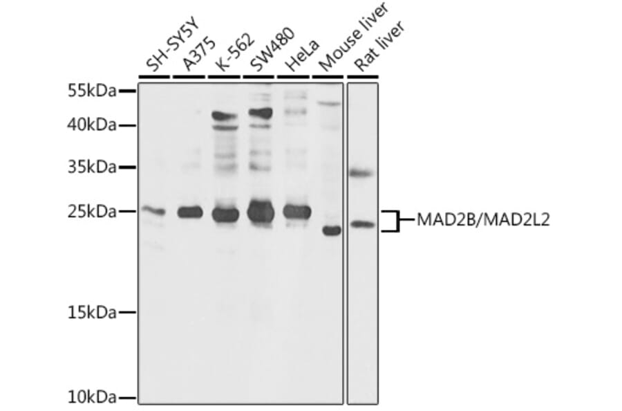 Western Blot - Anti-Mad2L2/REV7 Antibody (A88857) - Antibodies.com