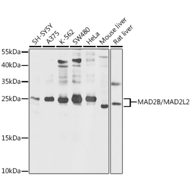 Western Blot - Anti-Mad2L2/REV7 Antibody (A88857) - Antibodies.com