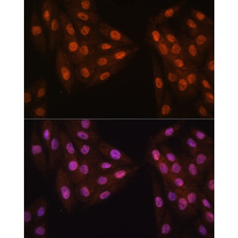 Immunofluorescence - Anti-Mad2L2/REV7 Antibody (A88857) - Antibodies.com