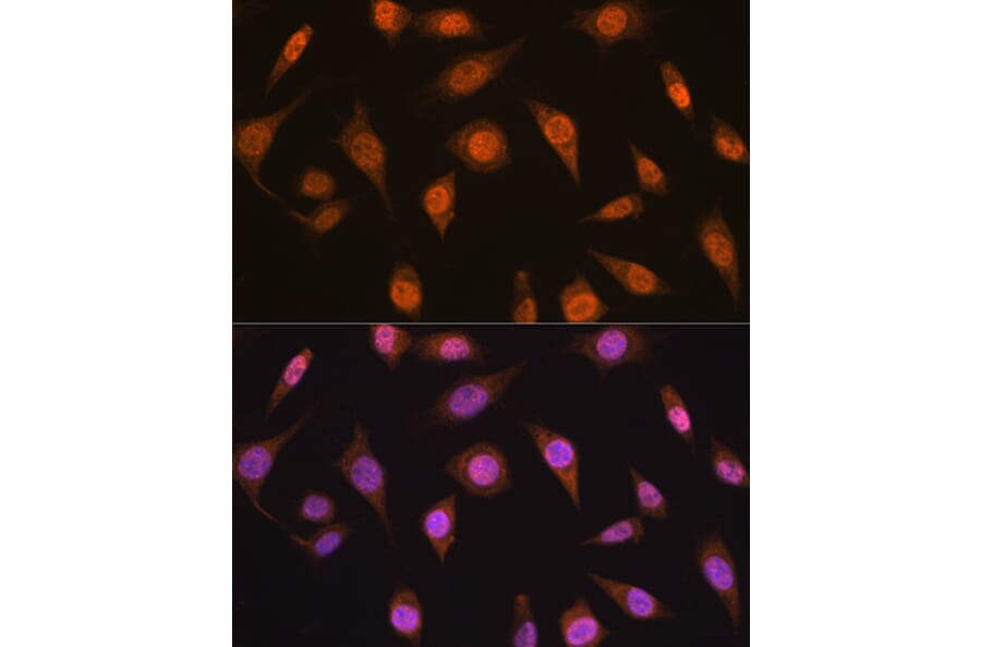 Immunofluorescence - Anti-Mad2L2/REV7 Antibody (A88857) - Antibodies.com