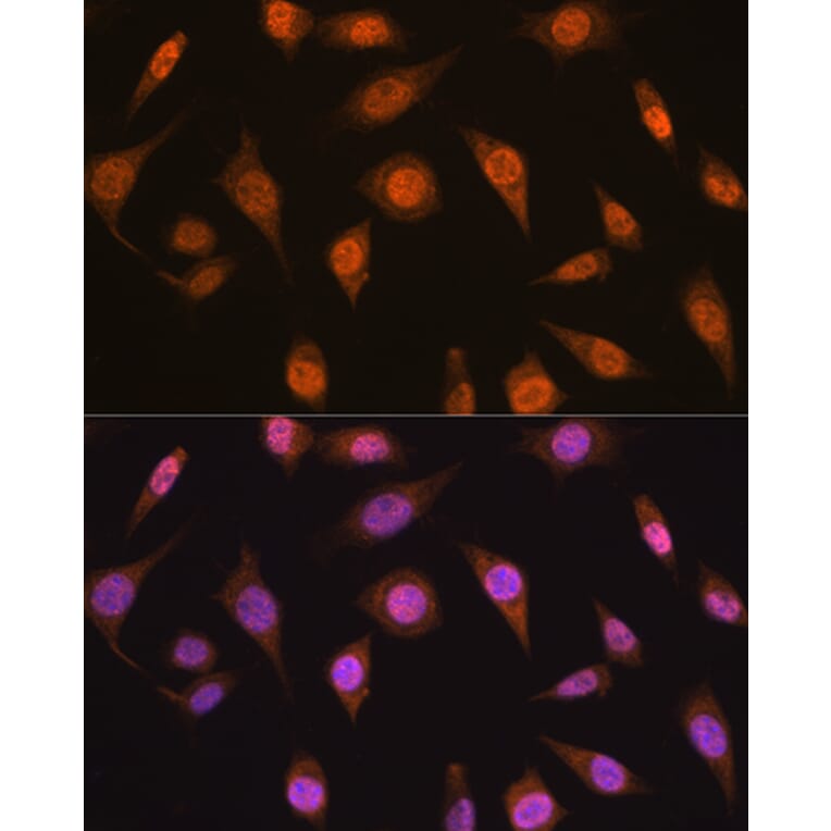 Immunofluorescence - Anti-Mad2L2/REV7 Antibody (A88857) - Antibodies.com