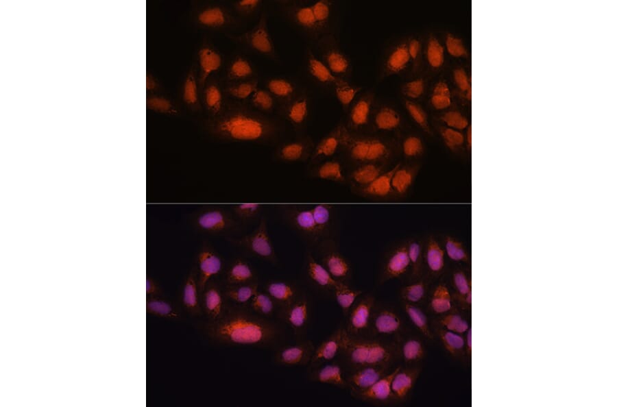 Immunofluorescence - Anti-Mad2L2/REV7 Antibody (A88857) - Antibodies.com