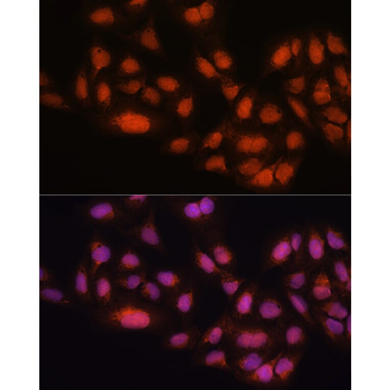 Immunofluorescence - Anti-Mad2L2/REV7 Antibody (A88857) - Antibodies.com