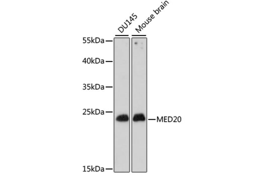 Western Blot - Anti-TRFP/MED20 Antibody (A88858) - Antibodies.com