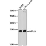 Western Blot - Anti-TRFP/MED20 Antibody (A88858) - Antibodies.com