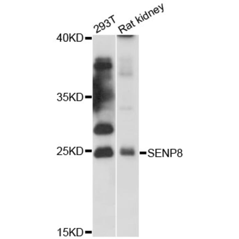 Western Blot - Anti-SENP8 Antibody (A12753) - Antibodies.com