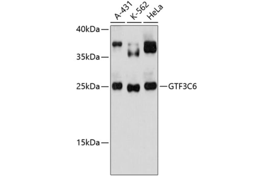 Western Blot - Anti-GTF3C6 Antibody (A88860) - Antibodies.com