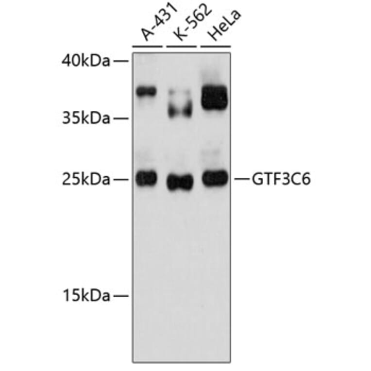 Western Blot - Anti-GTF3C6 Antibody (A88860) - Antibodies.com