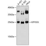 Western Blot - Anti-GTF3C6 Antibody (A88860) - Antibodies.com