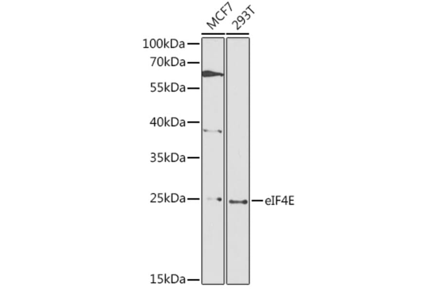 Western Blot - Anti-EIF4E Antibody (A88861) - Antibodies.com
