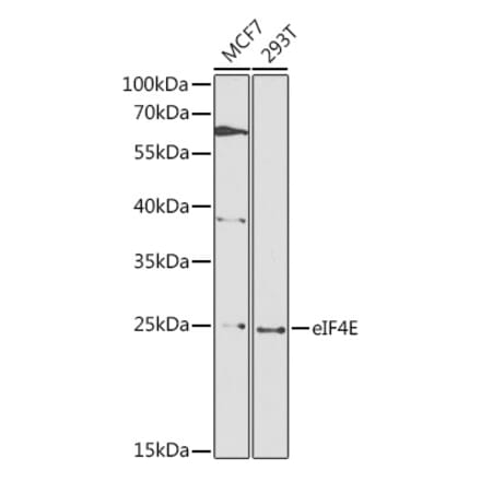 Western Blot - Anti-EIF4E Antibody (A88861) - Antibodies.com