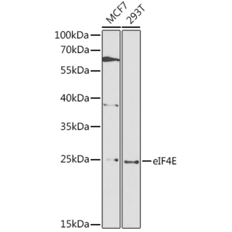 Western Blot - Anti-EIF4E Antibody (A88861) - Antibodies.com
