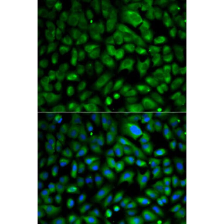 Immunofluorescence - Anti-EIF4E Antibody (A88861) - Antibodies.com
