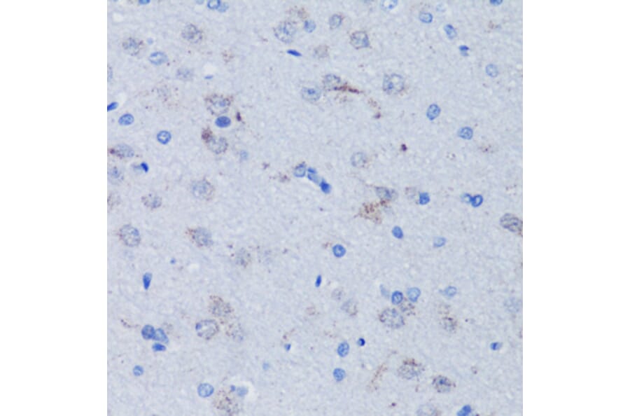 Immunohistochemistry - Anti-mtTFA Antibody (A88862) - Antibodies.com