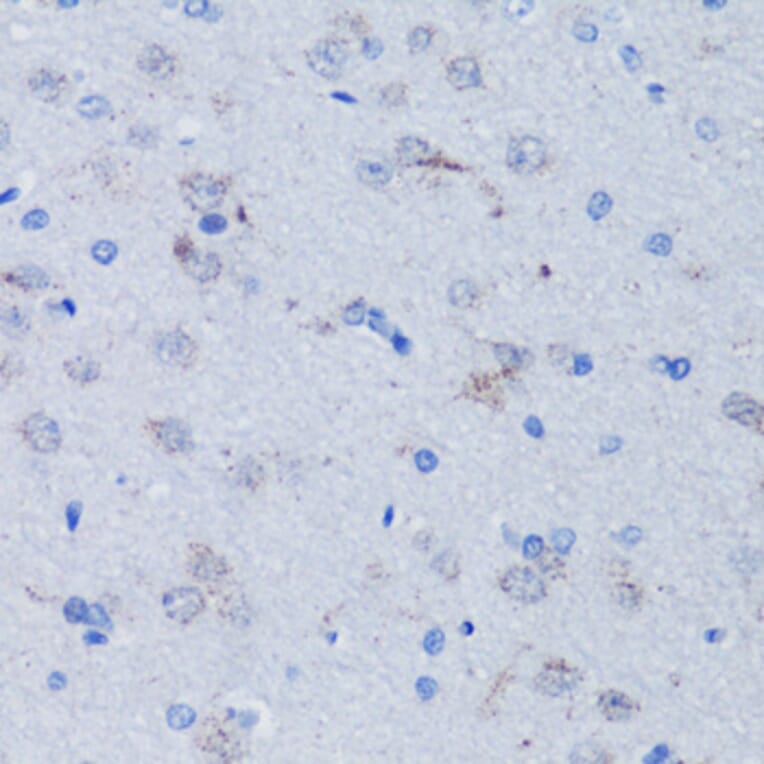 Immunohistochemistry - Anti-mtTFA Antibody (A88862) - Antibodies.com