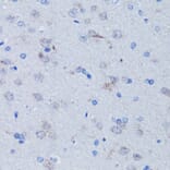 Immunohistochemistry - Anti-mtTFA Antibody (A88862) - Antibodies.com