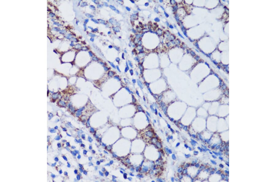 Immunohistochemistry - Anti-mtTFA Antibody (A88862) - Antibodies.com