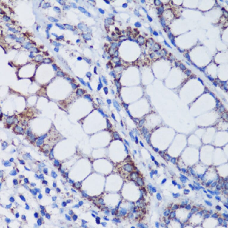 Immunohistochemistry - Anti-mtTFA Antibody (A88862) - Antibodies.com