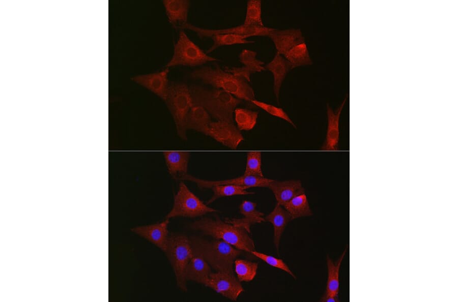 Immunofluorescence - Anti-mtTFA Antibody (A88862) - Antibodies.com