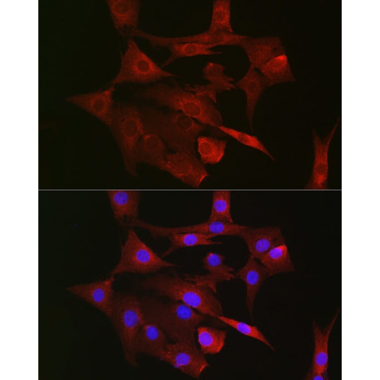 Immunofluorescence - Anti-mtTFA Antibody (A88862) - Antibodies.com