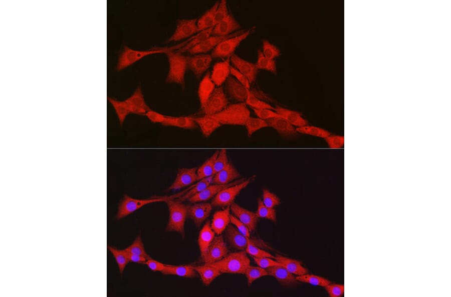 Immunofluorescence - Anti-mtTFA Antibody (A88862) - Antibodies.com