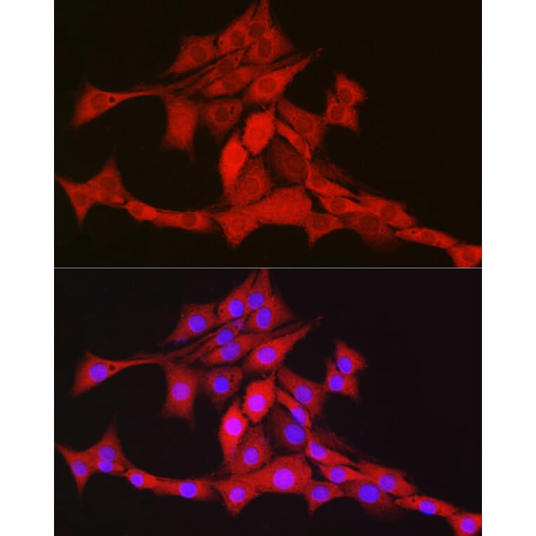 Immunofluorescence - Anti-mtTFA Antibody (A88862) - Antibodies.com