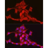 Immunofluorescence - Anti-mtTFA Antibody (A88862) - Antibodies.com