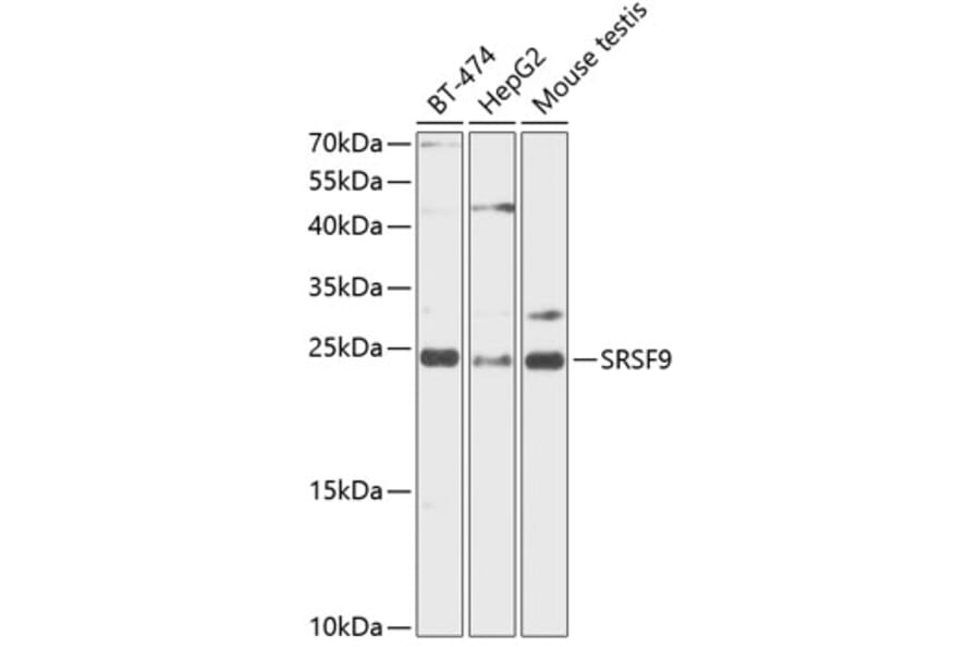 Western Blot - Anti-SFRS9/SRSF9 Antibody (A88863) - Antibodies.com