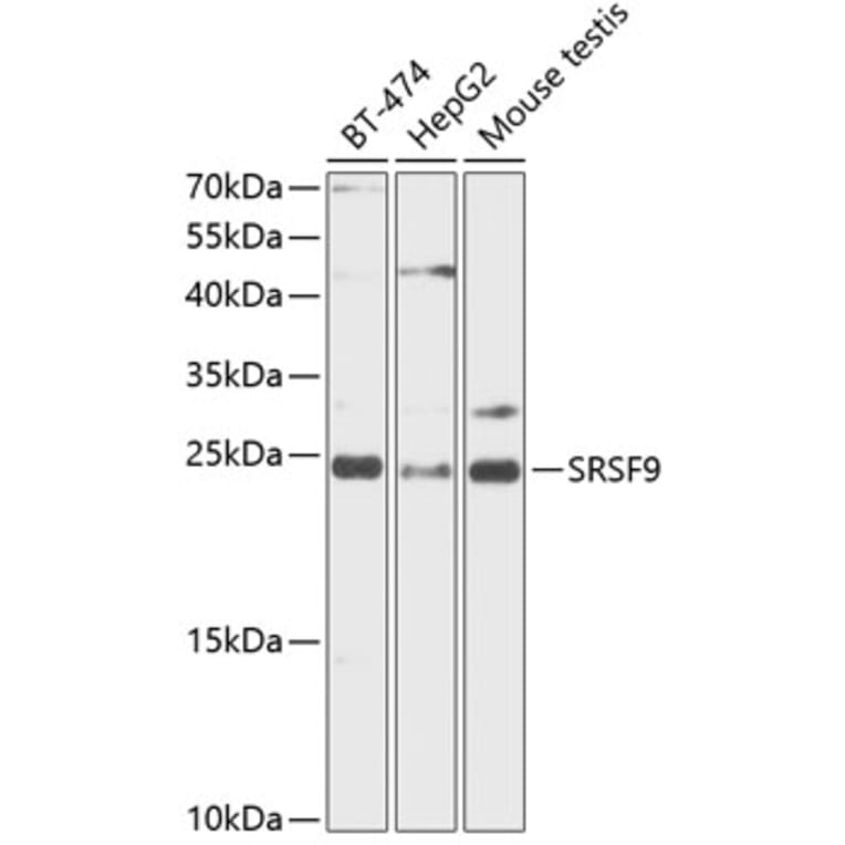 Western Blot - Anti-SFRS9/SRSF9 Antibody (A88863) - Antibodies.com