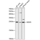 Western Blot - Anti-SFRS9/SRSF9 Antibody (A88863) - Antibodies.com