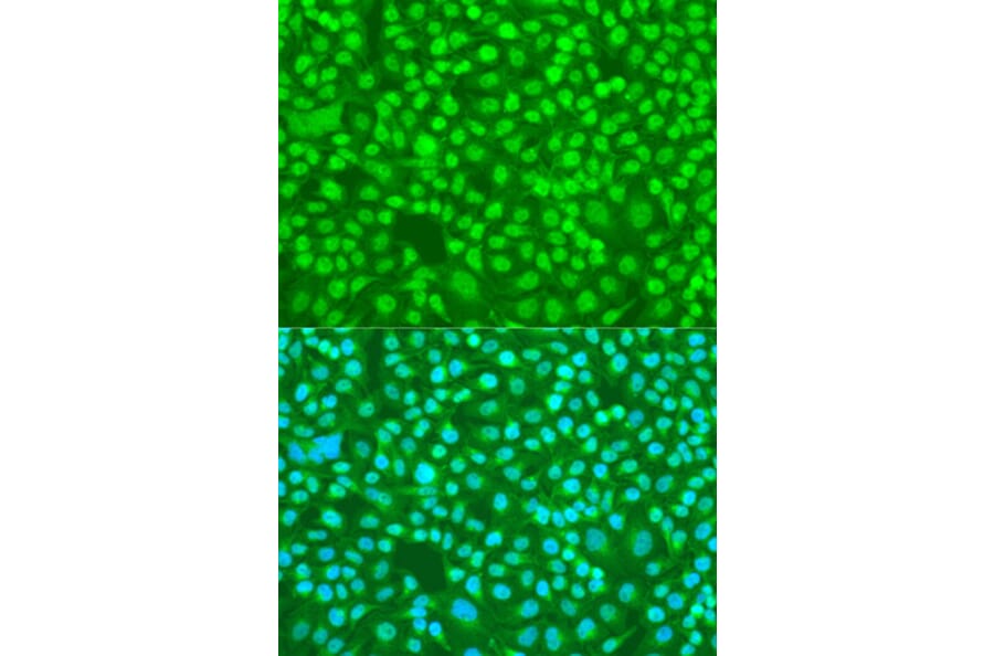 Immunofluorescence - Anti-SFRS9/SRSF9 Antibody (A88863) - Antibodies.com