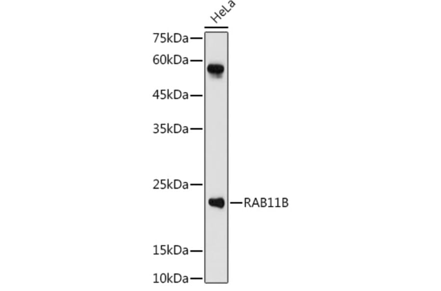 Western Blot - Anti-RAB11B Antibody (A88864) - Antibodies.com
