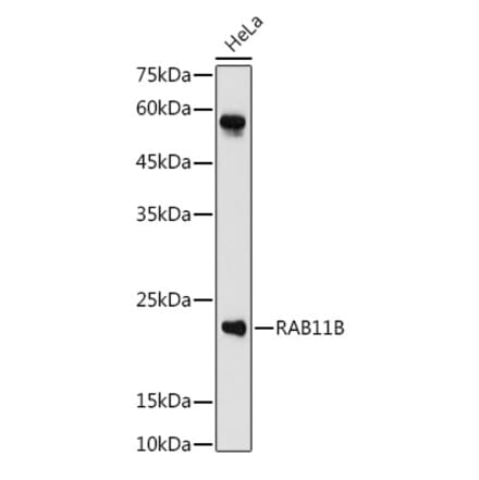 Western Blot - Anti-RAB11B Antibody (A88864) - Antibodies.com