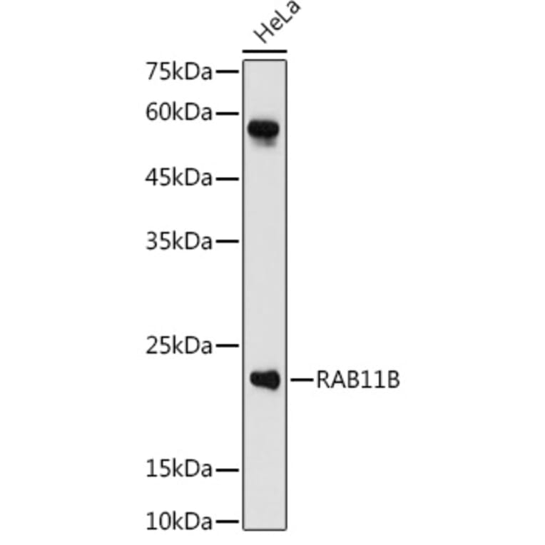 Western Blot - Anti-RAB11B Antibody (A88864) - Antibodies.com