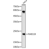 Western Blot - Anti-RAB11B Antibody (A88864) - Antibodies.com