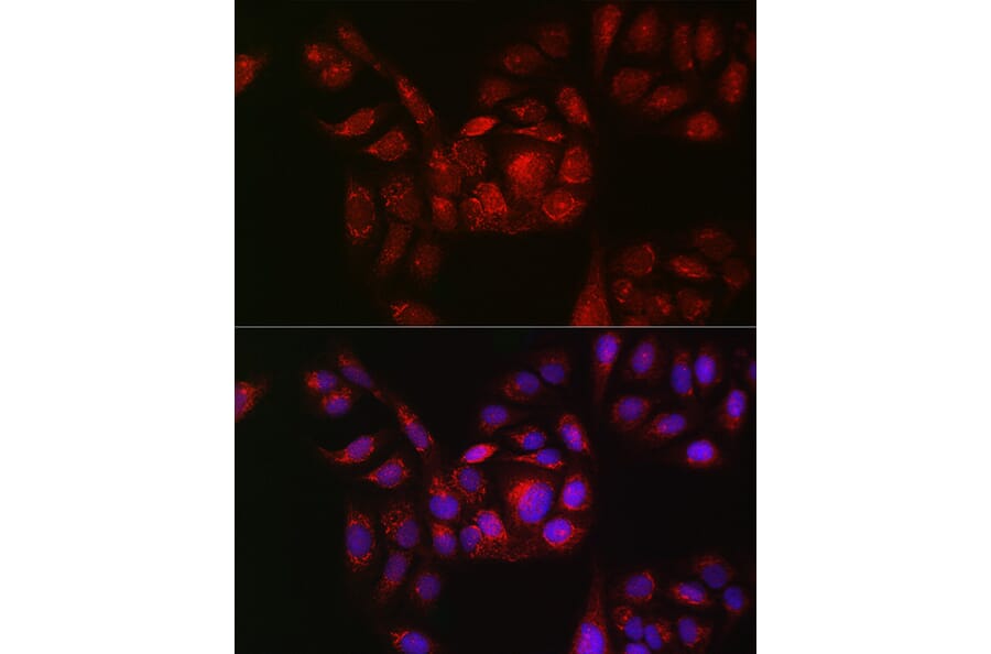 Immunofluorescence - Anti-RAB11B Antibody (A88864) - Antibodies.com