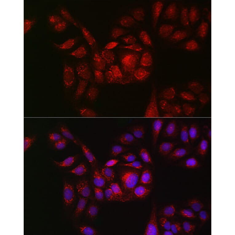 Immunofluorescence - Anti-RAB11B Antibody (A88864) - Antibodies.com