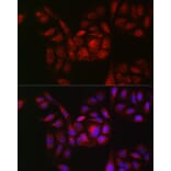 Immunofluorescence - Anti-RAB11B Antibody (A88864) - Antibodies.com