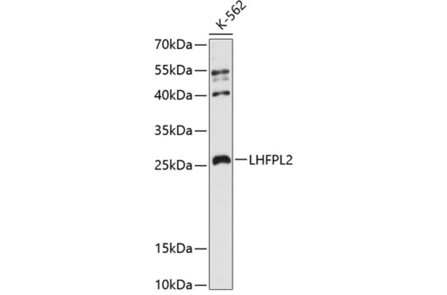 Western Blot - Anti-LHFPL2 Antibody (A88866) - Antibodies.com